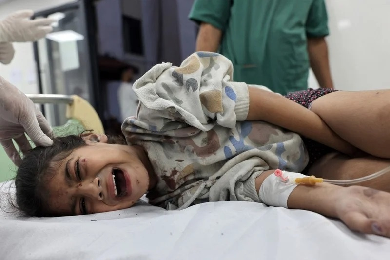 إحصائية صادمة ... 1000 طفل بُترت أطرافهم دون تخدير في غزة!