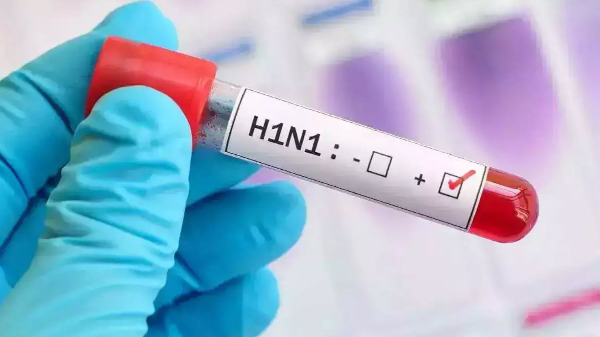 فيروس "H1N1" يجتاح لبنان!