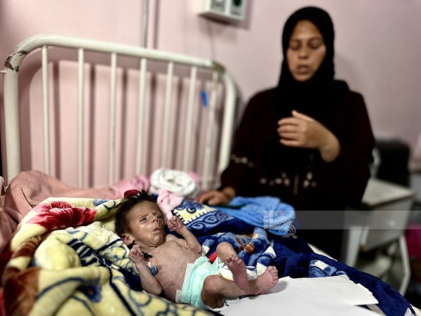 5 وفيات خلال الـ24 ساعة: وفاة رضيع نتيجة سوء التغذية والمجاعة في قطاع غزة