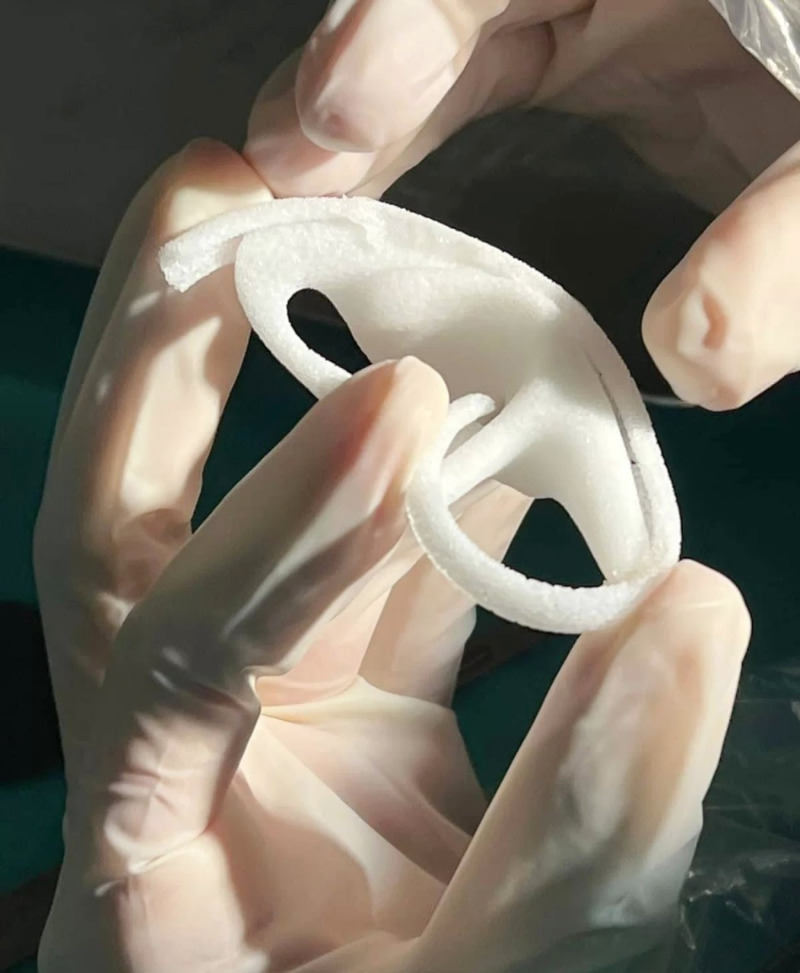 عمليتان طبيتان لتصنيع شكل الأذن الخارجية لأول مرة في مستشفى حمود