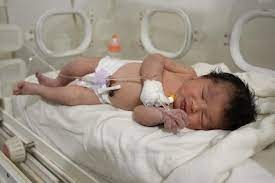 هذا هو حال الطفلة السورية التي ولدت تحت الانقاض