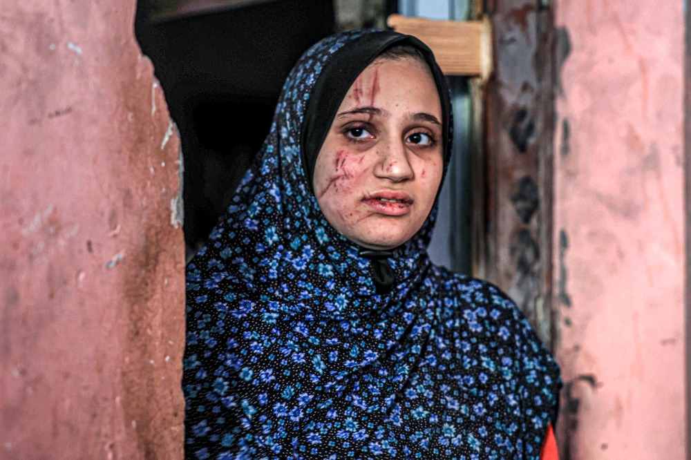 "آكشن إيد": ارتفاع حالات الإجهاض بين النساء الحوامل في قطاع غزة