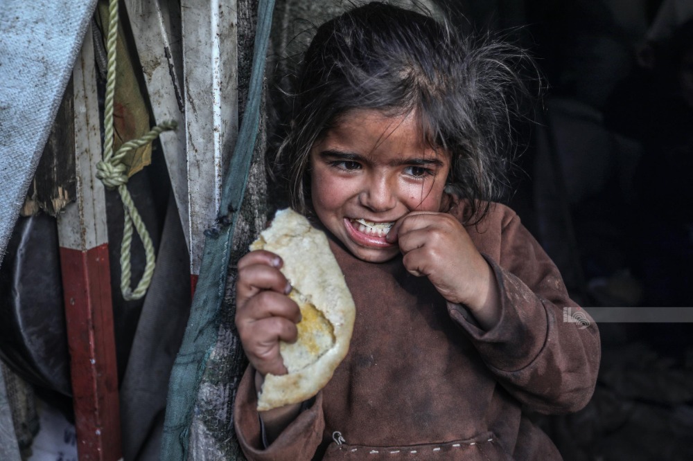 "الأونروا": أكثر من 50 ألف طفل في غزة يحتاجون للعلاج من سوء التغذية الحاد