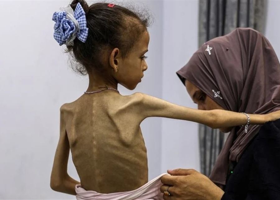 الأمم المتحدة: المجاعة مؤكّدة في مدينة غزة وهي من صنع "إسرائيل"