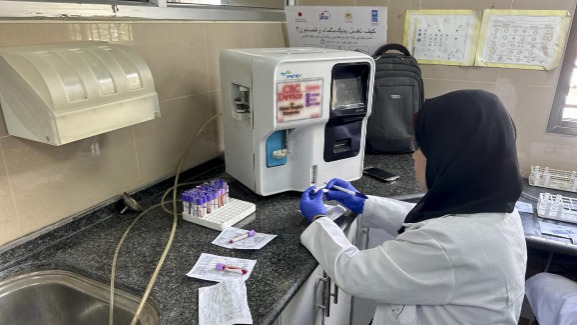 عجز بنسبة 87% بالمستلزمات المخبرية في قطاع غزة