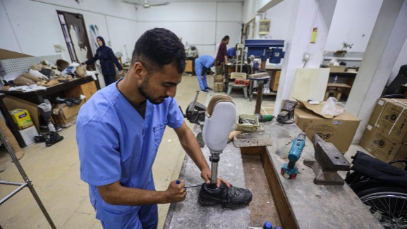 مبتورو الأطراف في غزة... قيود الاحتلال تعطل علاجهم واندماجهم