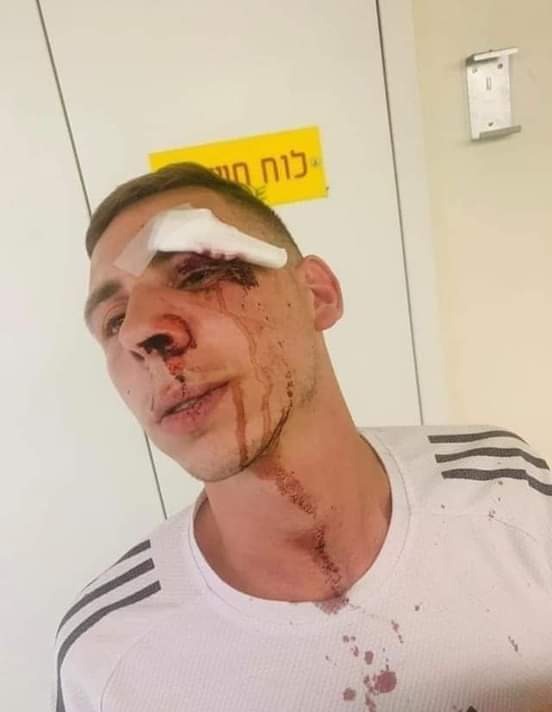 أثناء تواجده في مكان عمله ...  مستوطنون يعتدون بالضرب على الشاب أمير سلهب من حارة باب حطة في القدس
