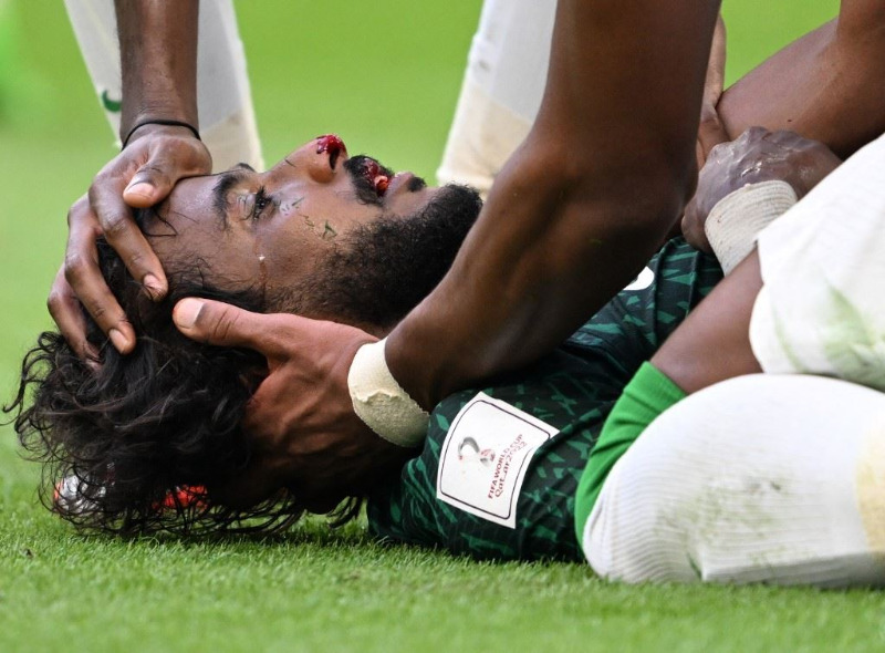 بالفيديو والصور.. إصابة لاعب السعودية تحبس الأنفاس... وولي العهد يأمر بنقله إلى ألمانيا