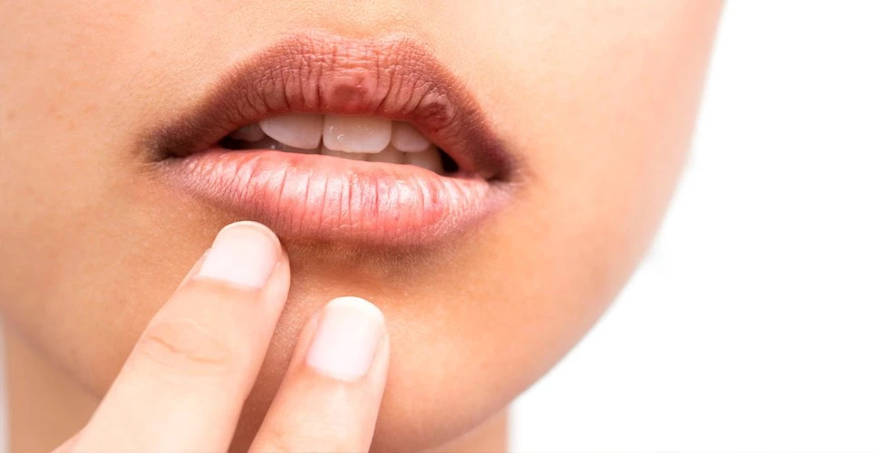 احذر.. جفاف الفم قد يكون عارضاً لـ5 أمراض خطيرة!
